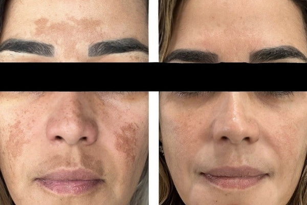 نتيجة العميلة نورة