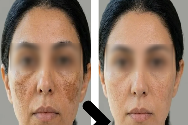 نتيجة العميلة مريم